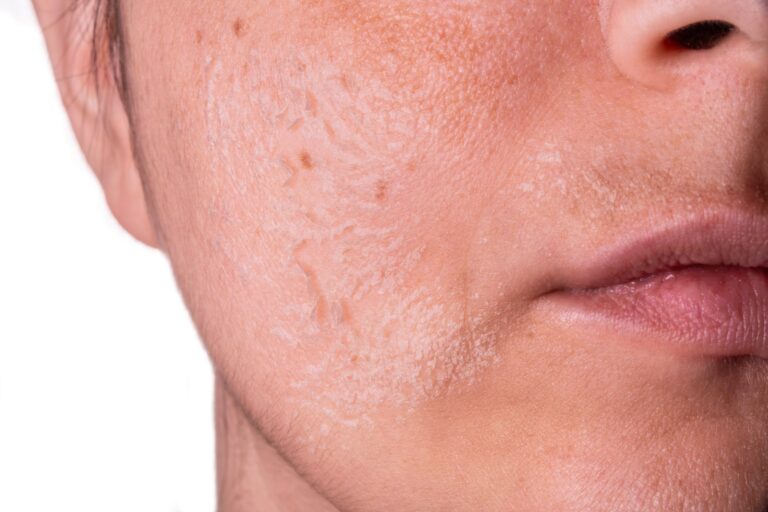 Mapa Twojej twarzy – co lokalizacja niedoskonałości mówi o zdrowiu?